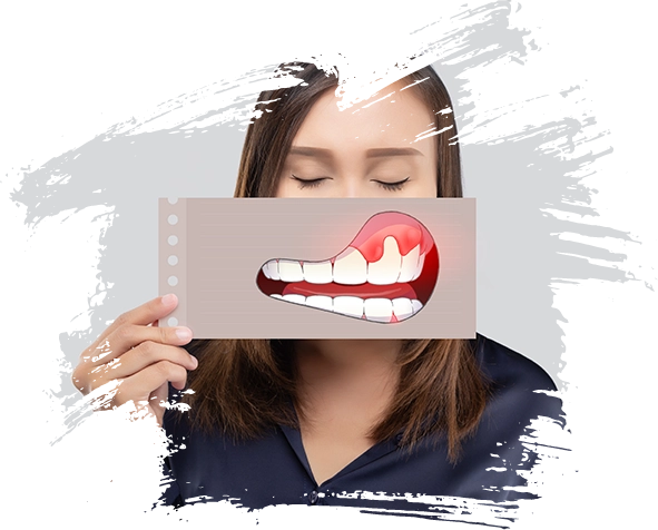 Moderne Behandlungsansätze bei Zahnfleischentzündungen